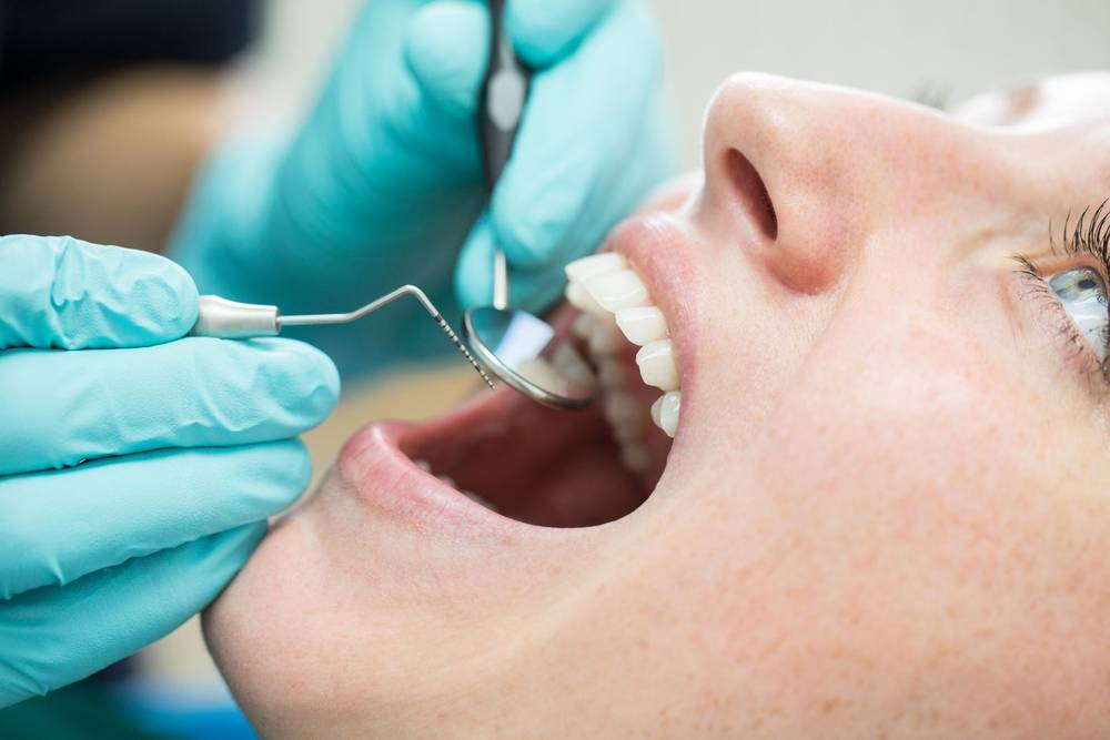 Una seduta di igiene dentale