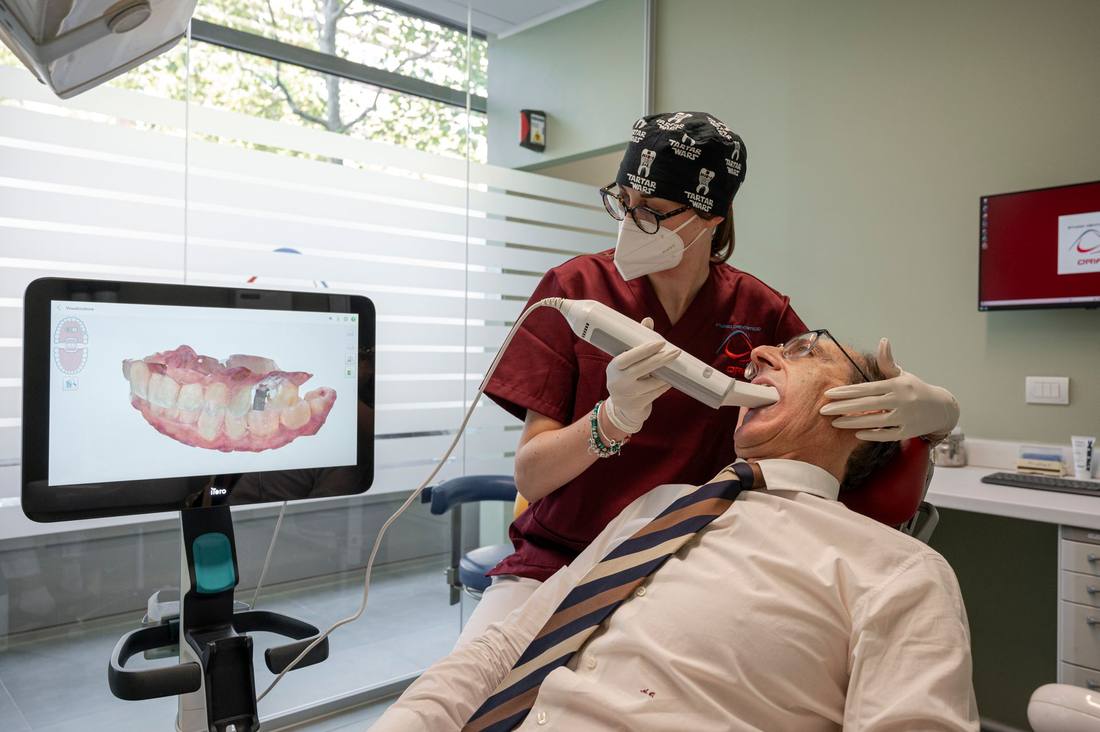 Una scansione con lo scanner intraorale, con il modello dei denti sullo schermo