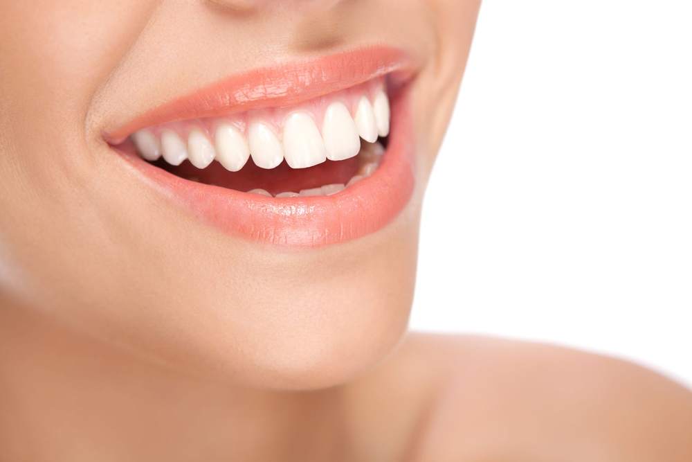 Un sorriso con i denti bianchi